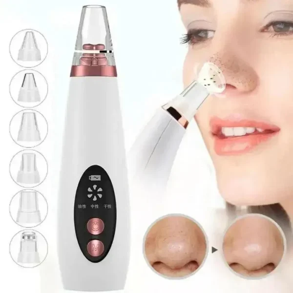 blackhead remover